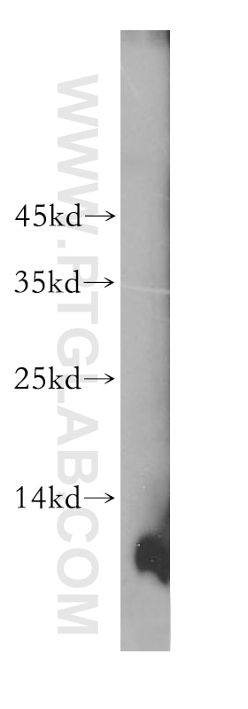 Western Blot (WB) analysis of human testis tissue using CKS2 Polyclonal antibody (15616-1-AP)