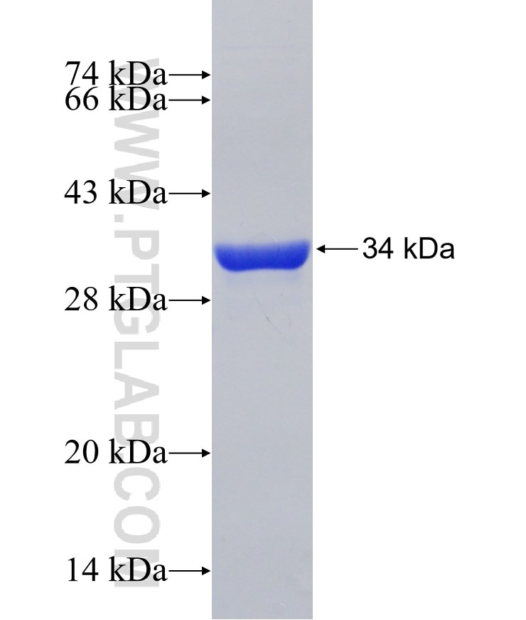 CKS2 fusion protein Ag31085 SDS-PAGE