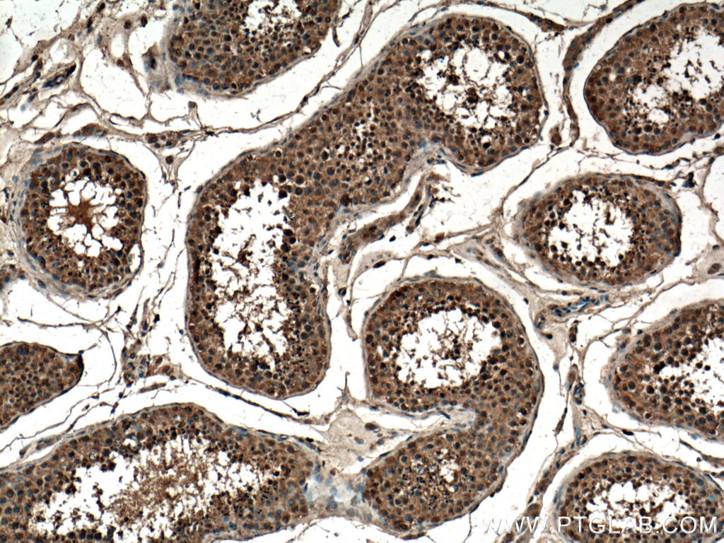 Immunohistochemistry (IHC) staining of human testis tissue using CLASP1 Polyclonal antibody (20803-1-AP)