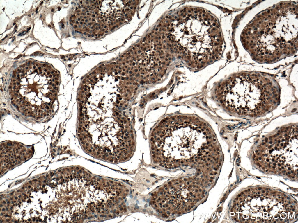 IHC staining of human testis using 20803-1-AP