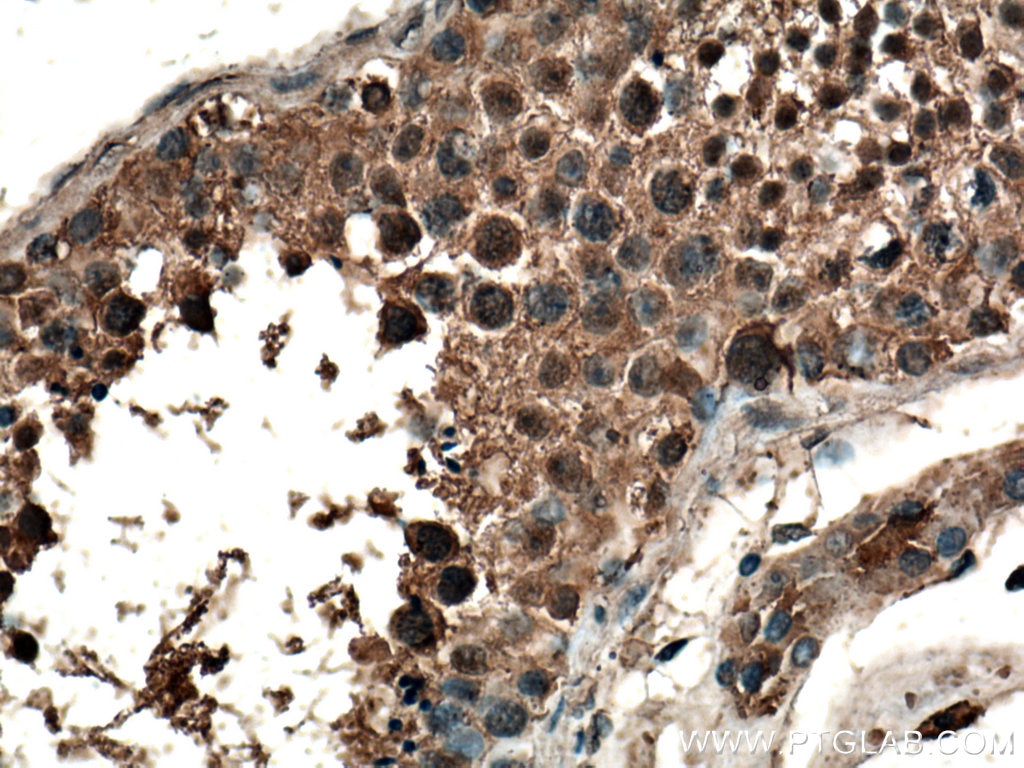 Immunohistochemistry (IHC) staining of human testis tissue using CLASP1 Polyclonal antibody (20803-1-AP)