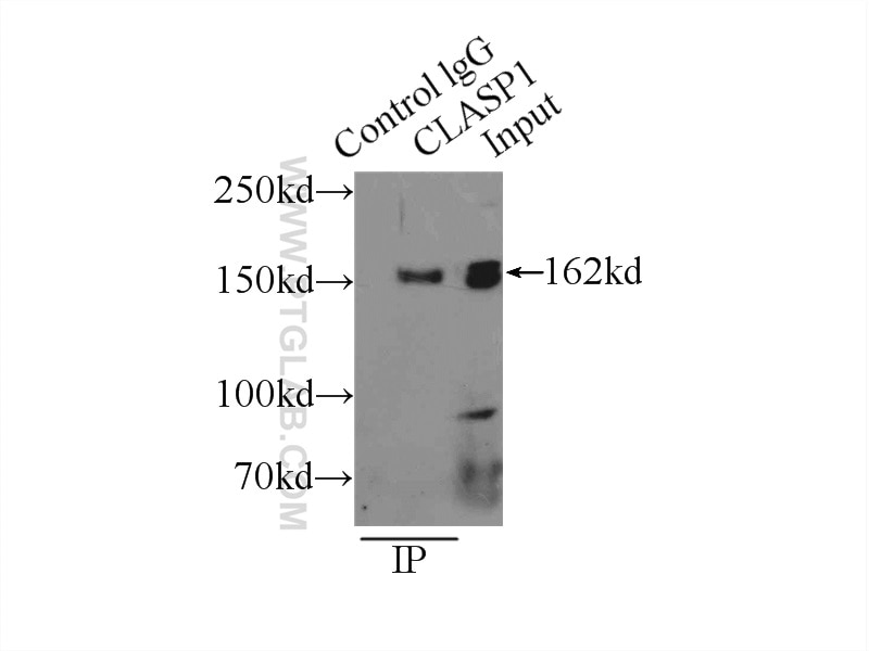 Immunoprecipitation (IP) experiment of HeLa cells using CLASP1 Polyclonal antibody (20803-1-AP)
