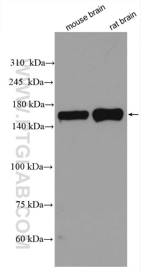 Western Blot (WB) analysis of various lysates using CLASP1 Polyclonal antibody (20803-1-AP)
