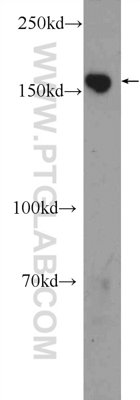 CLASP1 Polyclonal antibody