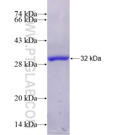 CLASP1 fusion protein Ag14724 SDS-PAGE