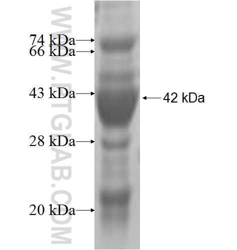 CLASP1 fusion protein Ag4651 SDS-PAGE