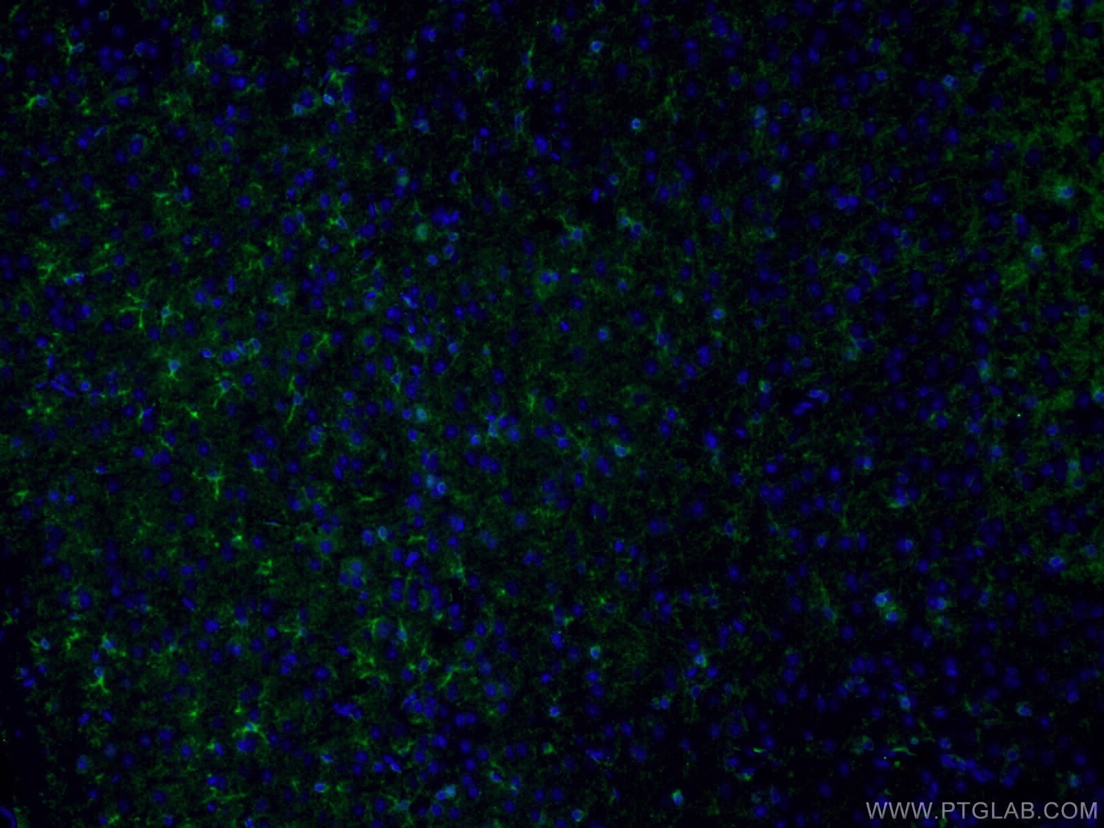 Immunofluorescence (IF) / fluorescent staining of mouse brain tissue using CLASP2 Polyclonal antibody (12942-1-AP)