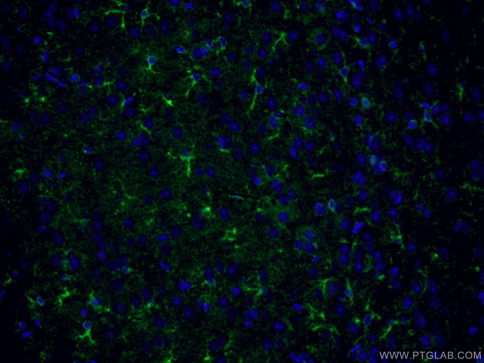 Immunofluorescence (IF) / fluorescent staining of mouse brain tissue using CLASP2 Polyclonal antibody (12942-1-AP)