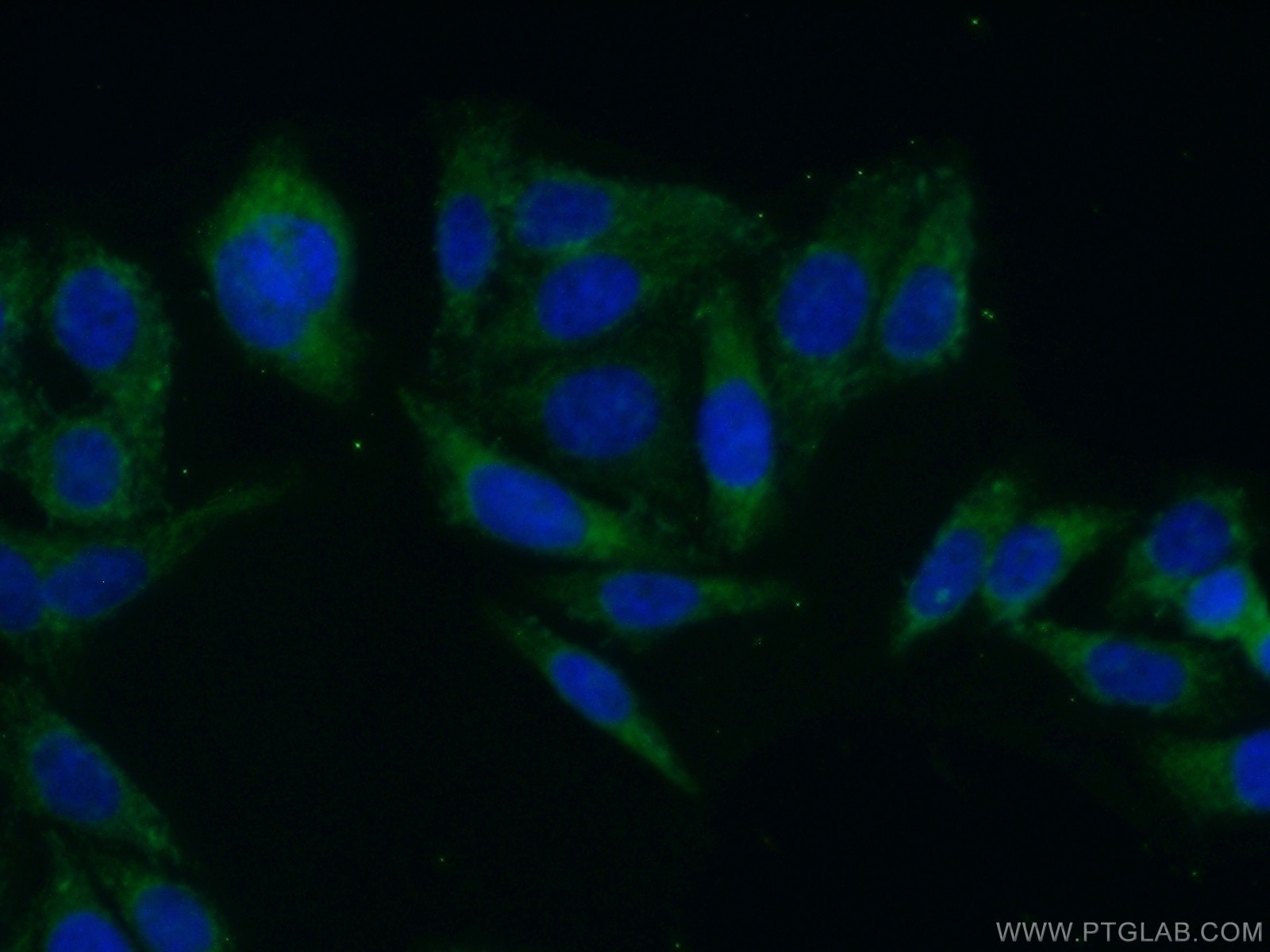 Immunofluorescence (IF) / fluorescent staining of HepG2 cells using CLASP2 Polyclonal antibody (12942-1-AP)