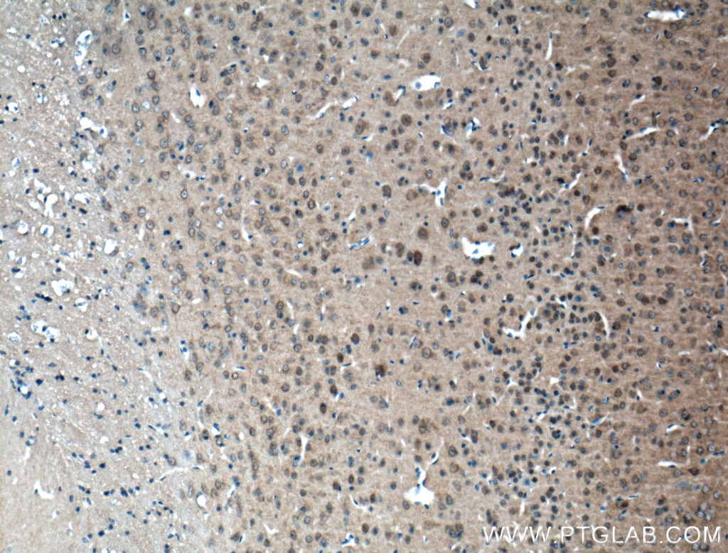 Immunohistochemistry (IHC) staining of mouse brain tissue using CLASP2 Polyclonal antibody (12942-1-AP)