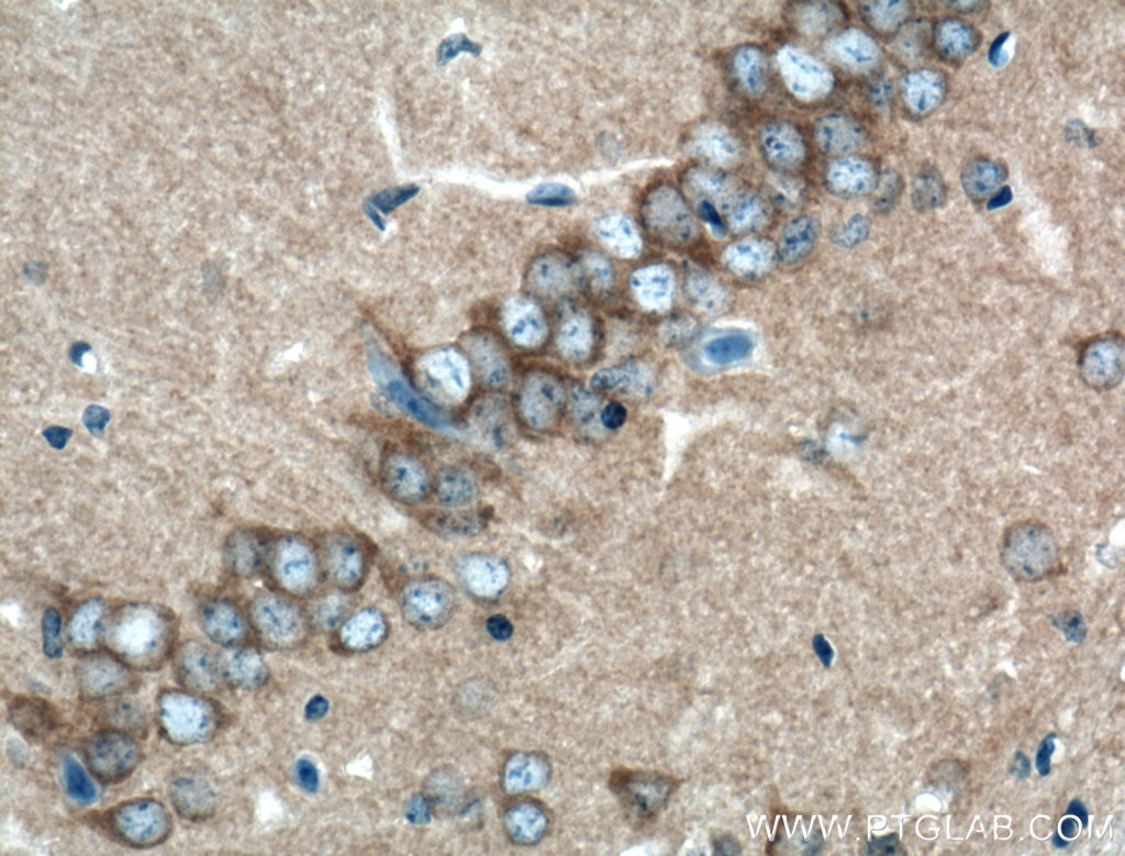 Immunohistochemistry (IHC) staining of mouse brain tissue using CLASP2 Polyclonal antibody (12942-1-AP)