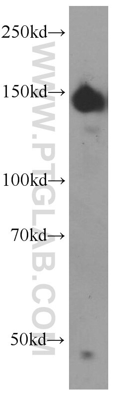 Western Blot (WB) analysis of human brain tissue using CLASP2 Polyclonal antibody (12942-1-AP)