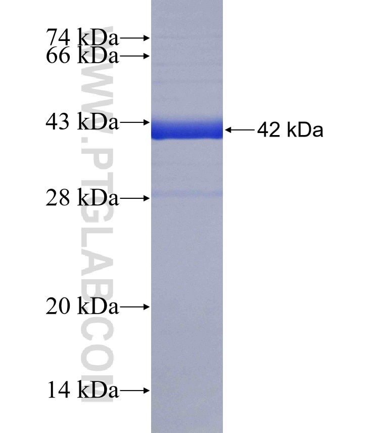 CLC fusion protein Ag18569 SDS-PAGE