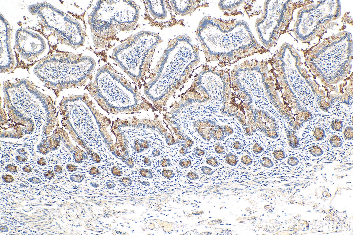 Immunohistochemistry (IHC) staining of human small intestine tissue using CLCA1 Polyclonal antibody (25291-1-AP)