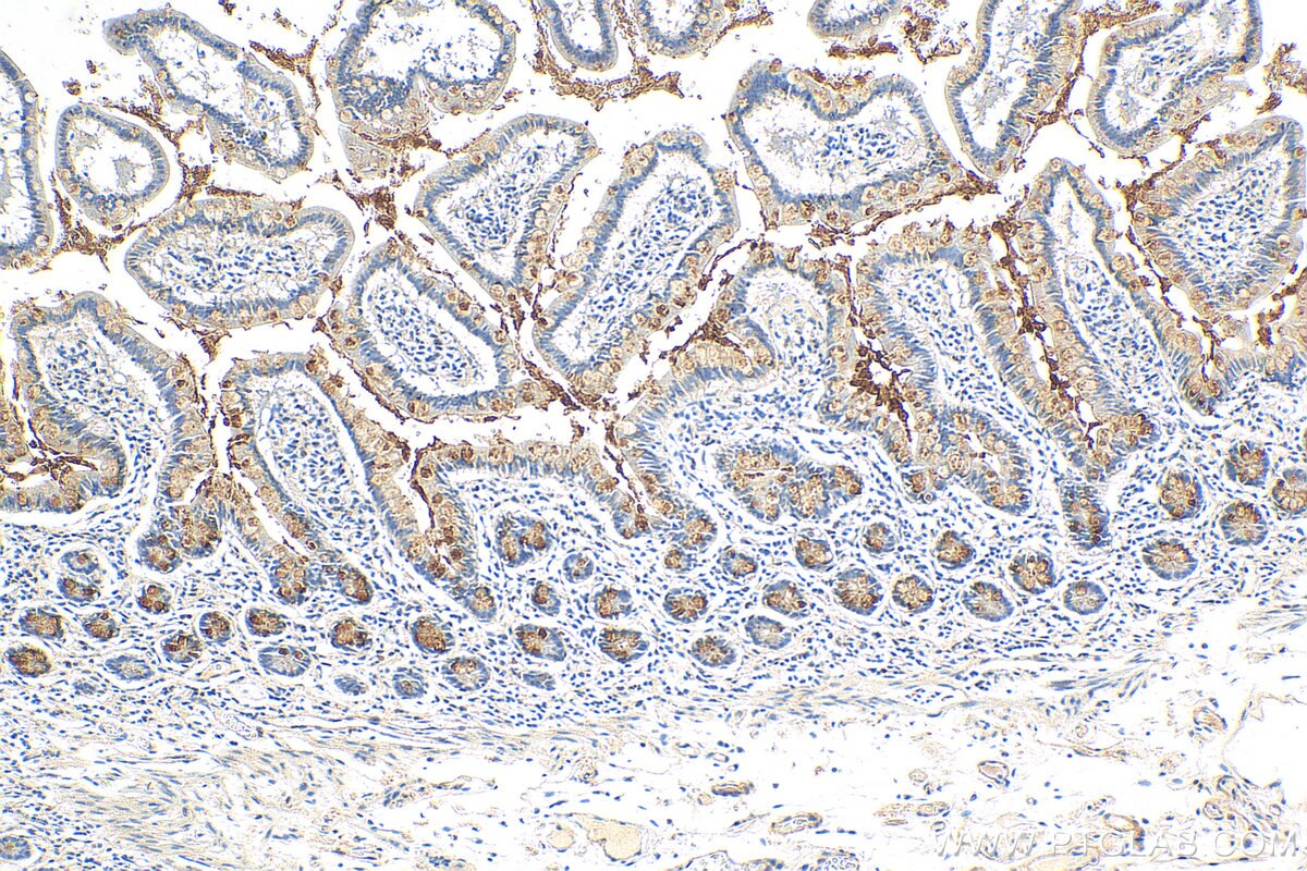 Immunohistochemistry (IHC) staining of human small intestine tissue using CLCA1 Polyclonal antibody (25291-1-AP)