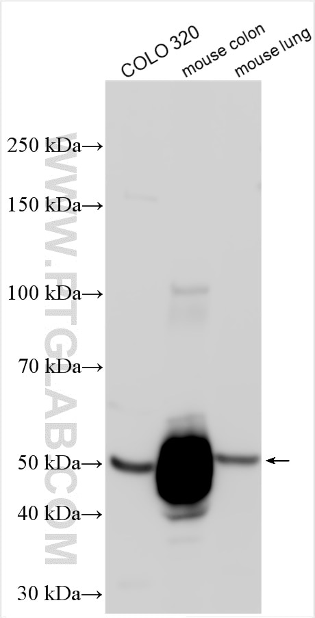 Western Blot (WB) analysis of various lysates using CLCA1 Polyclonal antibody (25291-1-AP)