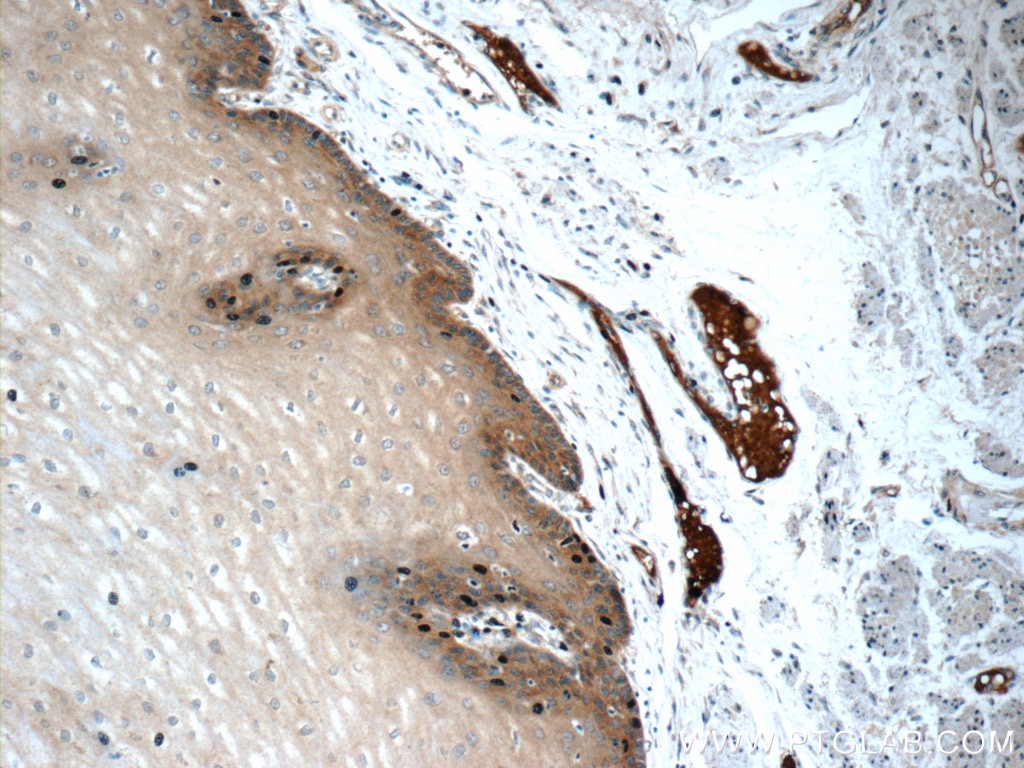 Immunohistochemistry (IHC) staining of human oesophagus tissue using CLCA2 Polyclonal antibody (19273-1-AP)
