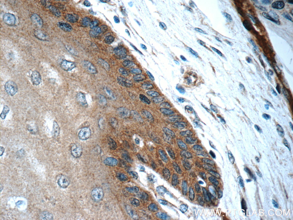 Immunohistochemistry (IHC) staining of human oesophagus tissue using CLCA2 Polyclonal antibody (19273-1-AP)