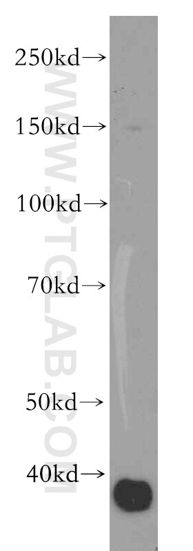 WB analysis of COLO 320 using 19273-1-AP