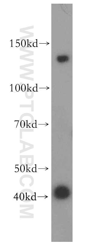 Western Blot (WB) analysis of mouse lung tissue using CLCA2 Polyclonal antibody (19273-1-AP)