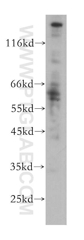 Western Blot (WB) analysis of MCF-7 cells using CLCA2 Monoclonal antibody (60118-1-Ig)