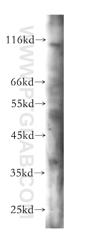 Western Blot (WB) analysis of A549 cells using CLCA2 Monoclonal antibody (60118-2-Ig)