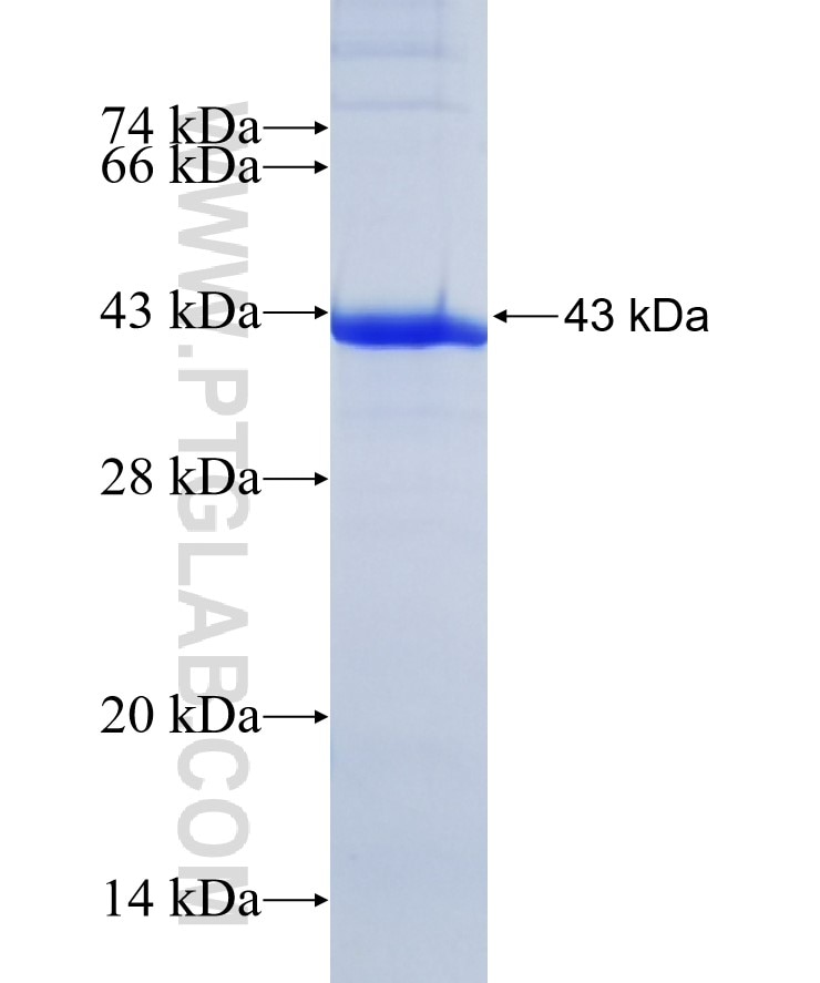 CLCA2 fusion protein Ag5914 SDS-PAGE