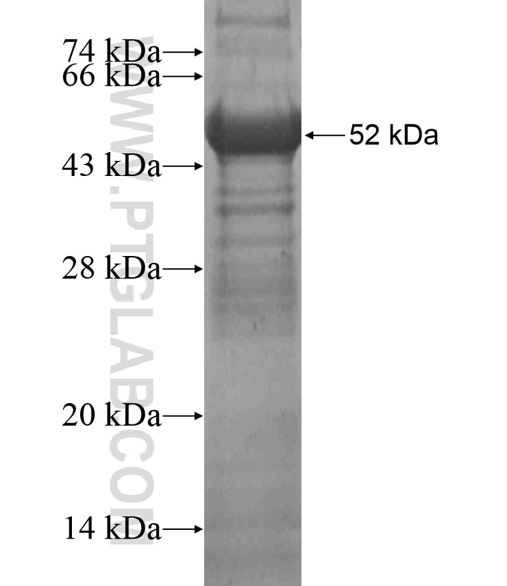 CLCA4 fusion protein Ag18243 SDS-PAGE