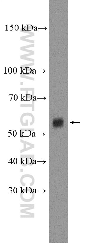 Western Blot (WB) analysis of COLO 320 cells using CLCC1 Polyclonal antibody (26680-1-AP)