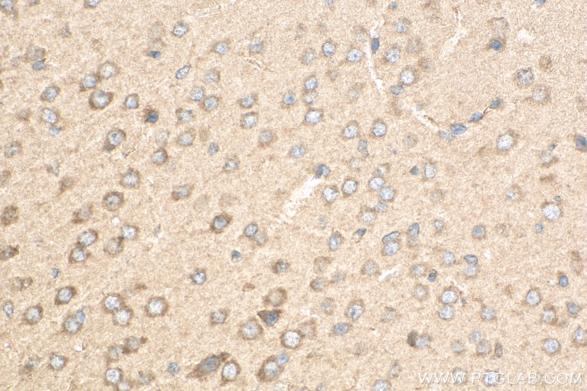 Immunohistochemistry (IHC) staining of mouse brain tissue using CLCN1 Polyclonal antibody (18595-1-AP)