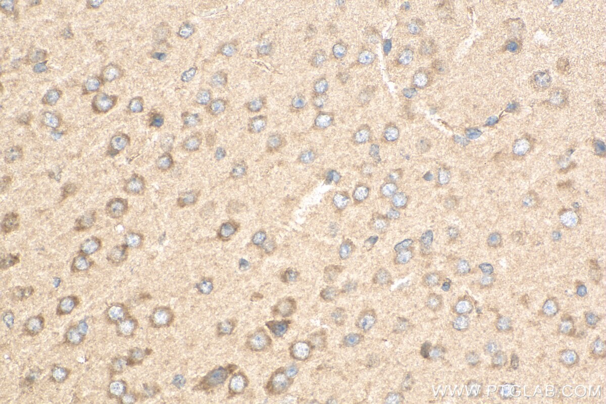 Immunohistochemistry (IHC) staining of mouse brain tissue using CLCN1 Polyclonal antibody (18595-1-AP)