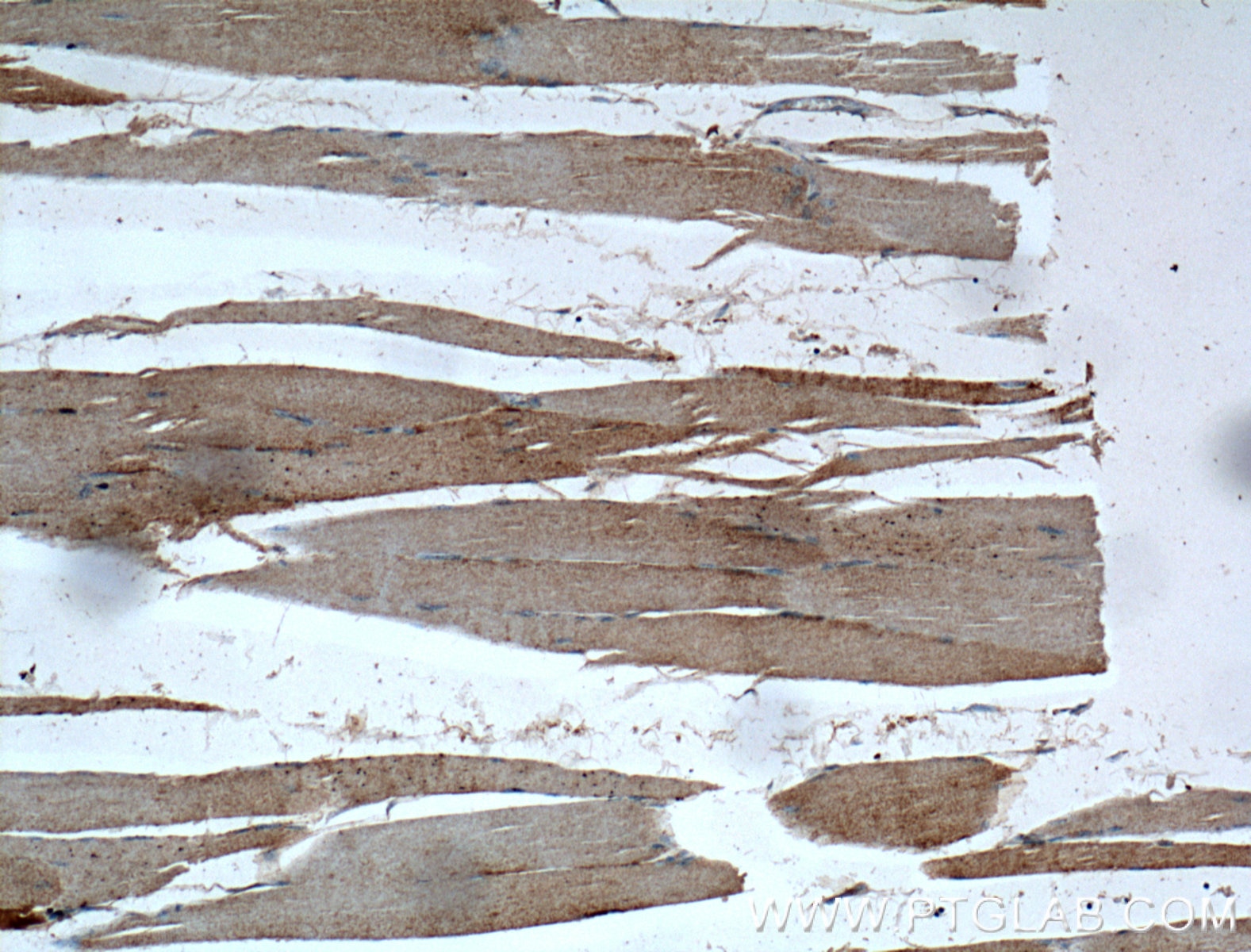 Immunohistochemistry (IHC) staining of human skeletal muscle tissue using CLCN1 Polyclonal antibody (18595-1-AP)