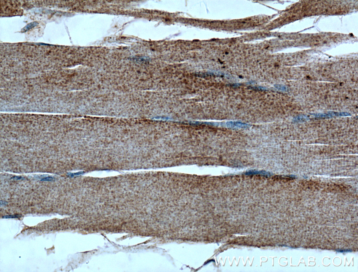 Immunohistochemistry (IHC) staining of human skeletal muscle tissue using CLCN1 Polyclonal antibody (18595-1-AP)