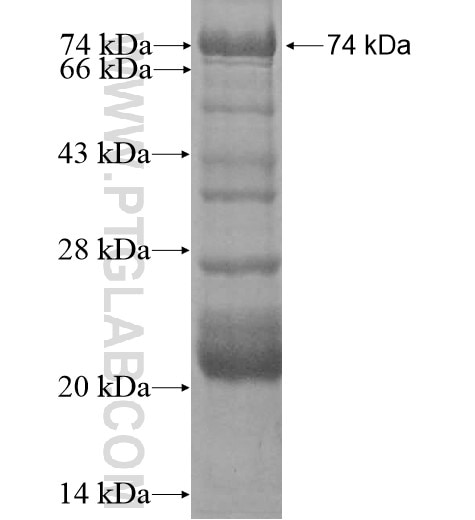 CLCN1 fusion protein Ag13336 SDS-PAGE