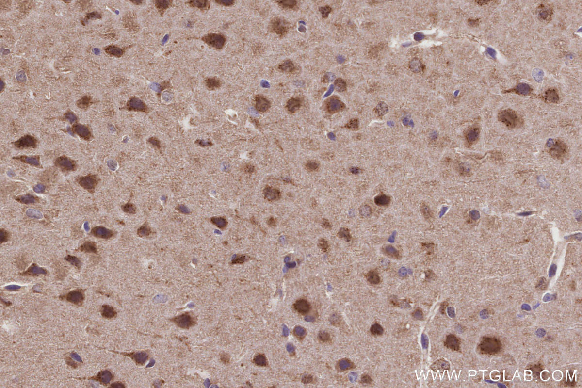 Immunohistochemistry (IHC) staining of mouse brain tissue using CLCN3 Polyclonal antibody (55330-1-AP)