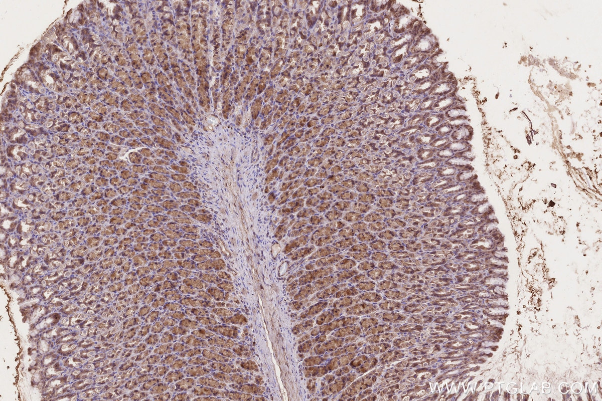 Immunohistochemistry (IHC) staining of rat stomach tissue using CLCN3 Polyclonal antibody (55330-1-AP)