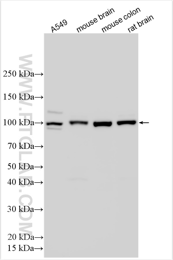 Western Blot (WB) analysis of various lysates using CLCN3 Polyclonal antibody (55330-1-AP)