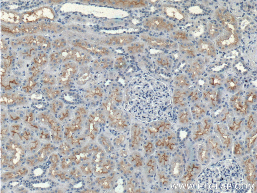 Immunohistochemistry (IHC) staining of human kidney tissue using CLCN5 Polyclonal antibody (26812-1-AP)