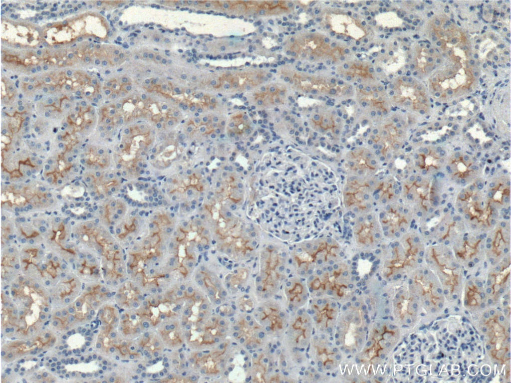 IHC staining of human kidney using 26812-1-AP