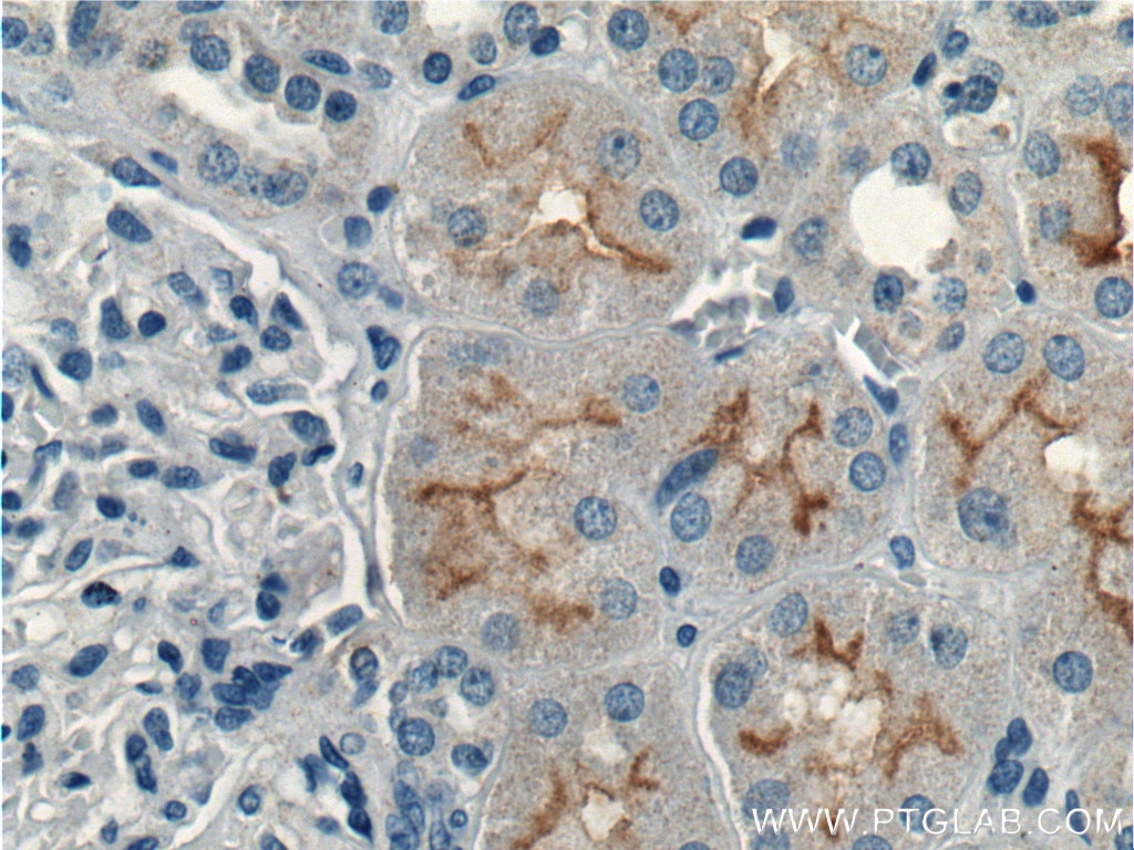 Immunohistochemistry (IHC) staining of human kidney tissue using CLCN5 Polyclonal antibody (26812-1-AP)