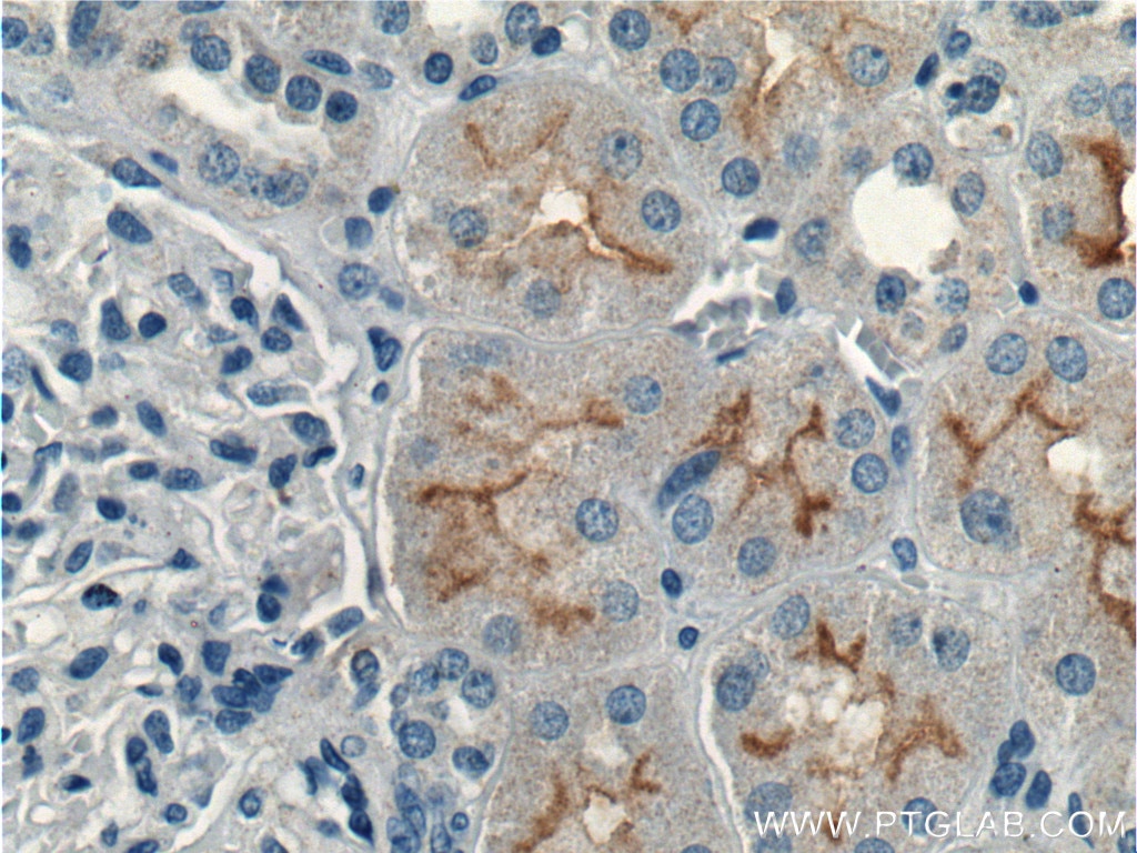 IHC staining of human kidney using 26812-1-AP