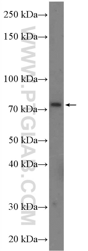 Western Blot (WB) analysis of mouse brain tissue using CLCN5 Polyclonal antibody (26812-1-AP)