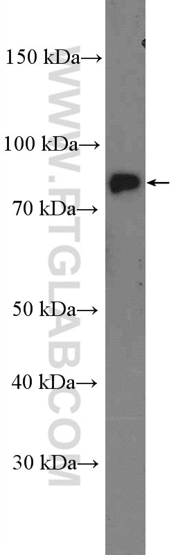Western Blot (WB) analysis of MDCK cells using CLCN5 Polyclonal antibody (26812-1-AP)