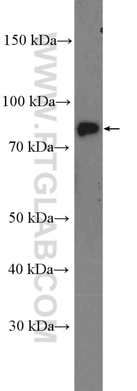 Western Blot (WB) analysis of MDCK cells using CLCN5 Polyclonal antibody (26812-1-AP)