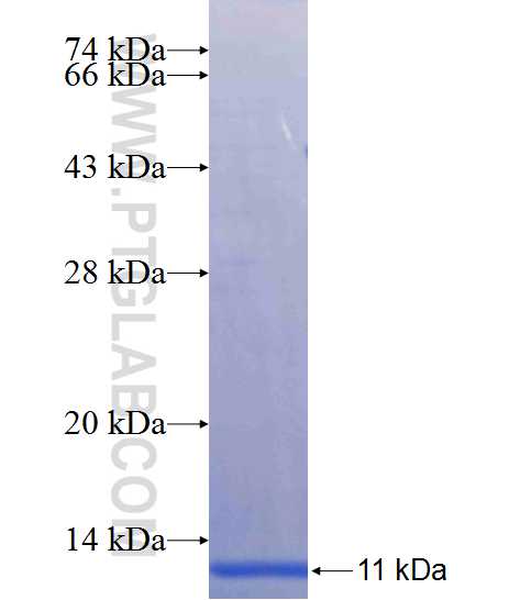 CLCN5 fusion protein Ag25182 SDS-PAGE