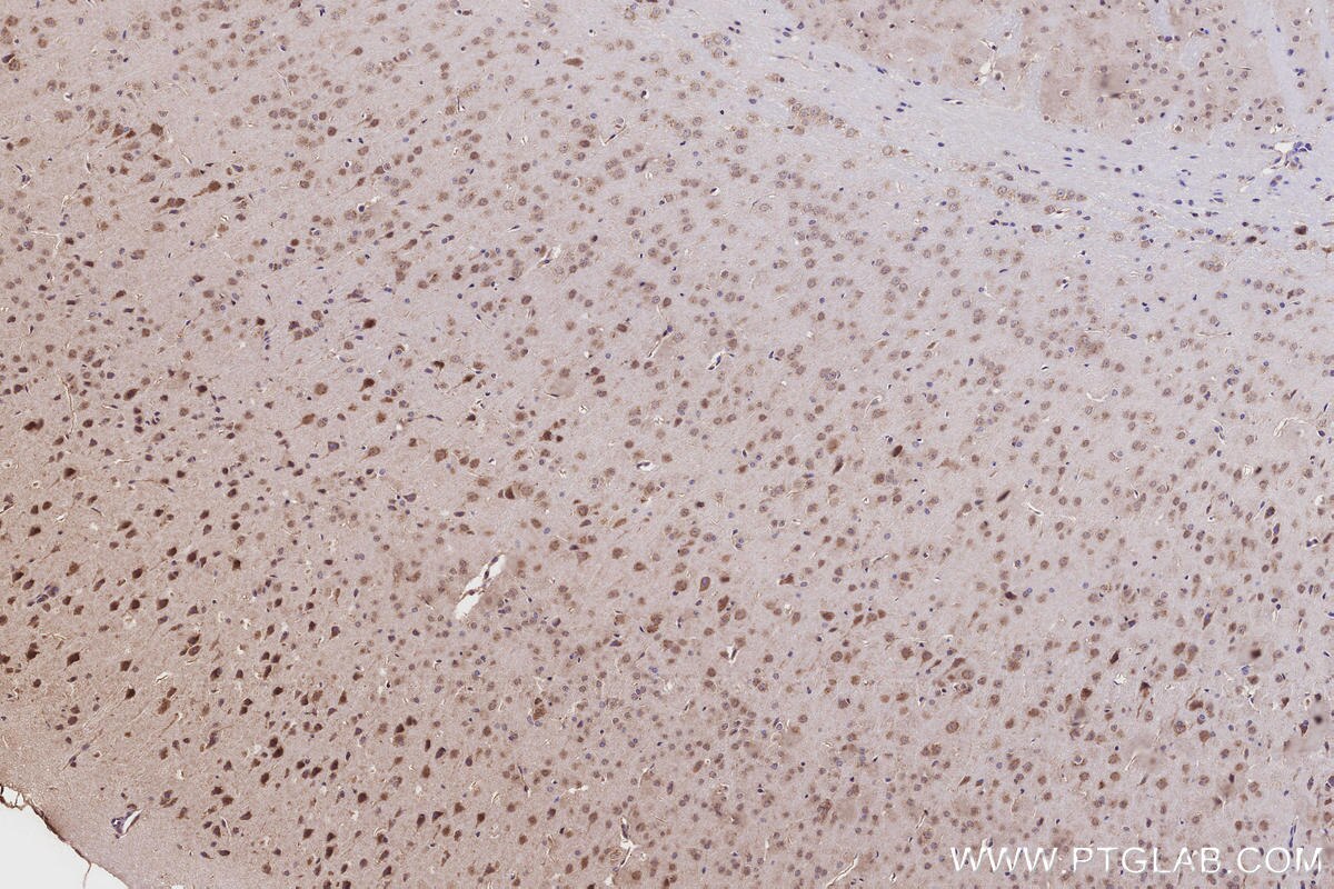 IHC staining of mouse brain using 29230-1-AP (same clone as 29230-1-PBS) Immunohistochemistry (IHC) staining of mouse brain tissue using CLCN7 Polyclonal antibody (29230-1-AP)