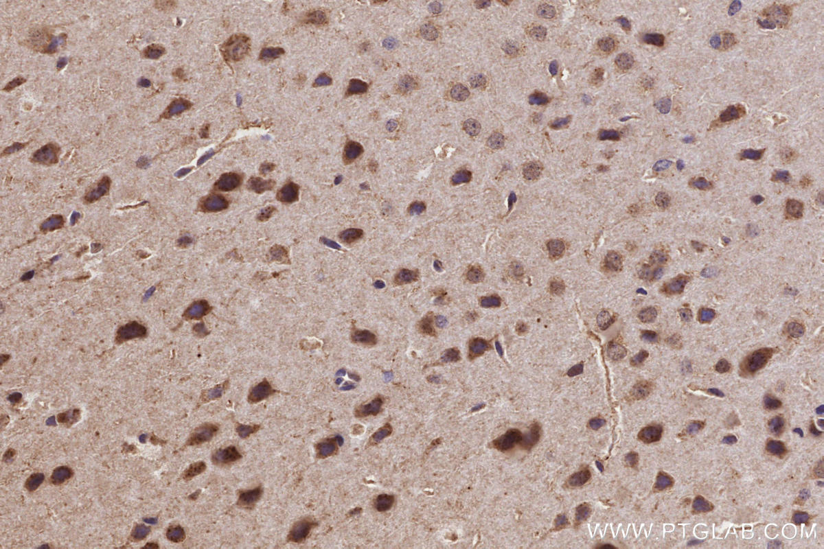 IHC staining of mouse brain using 29230-1-AP (same clone as 29230-1-PBS) Immunohistochemistry (IHC) staining of mouse brain tissue using CLCN7 Polyclonal antibody (29230-1-AP)