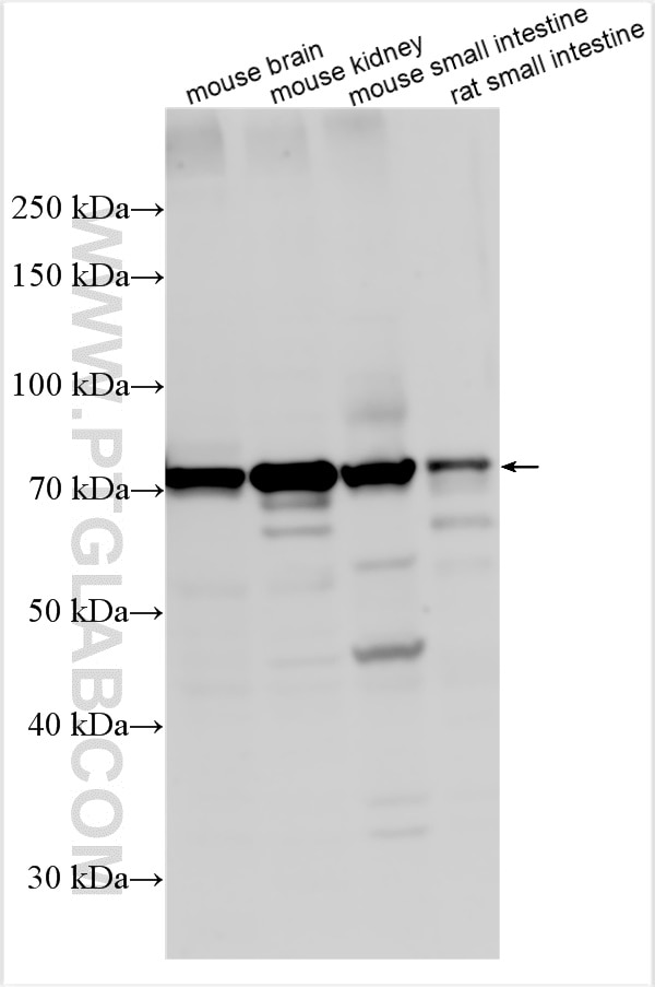 Western Blot (WB) analysis of various lysates using CLCN7 Polyclonal antibody (29230-1-AP)