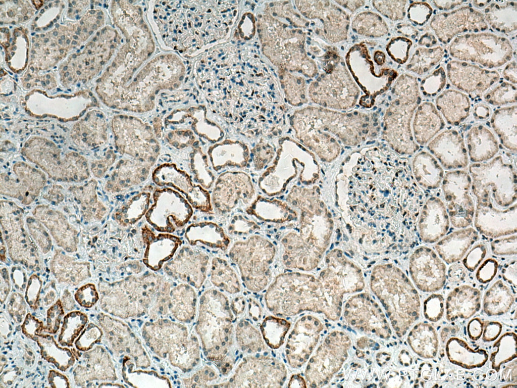 Immunohistochemistry (IHC) staining of human kidney tissue using CLCNKA Polyclonal antibody (14402-1-AP)