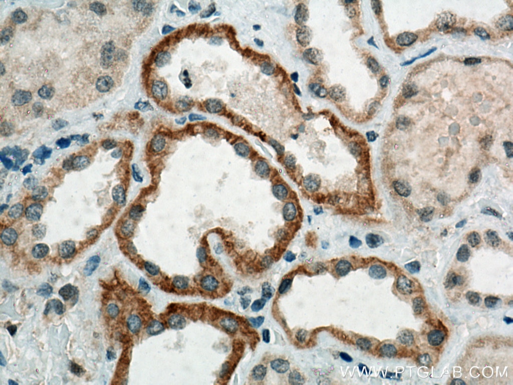 Immunohistochemistry (IHC) staining of human kidney tissue using CLCNKA Polyclonal antibody (14402-1-AP)